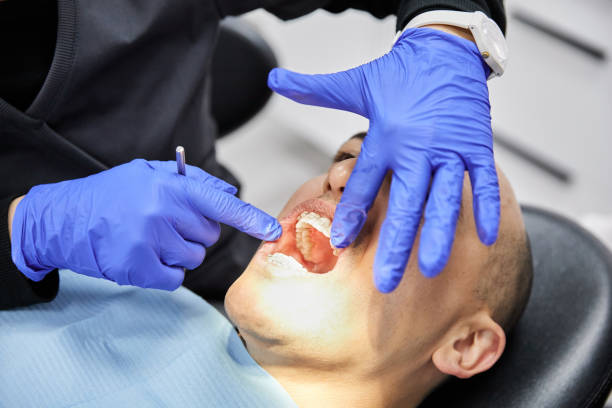 Best Broken or Chipped Tooth Repair in Liberty, MO